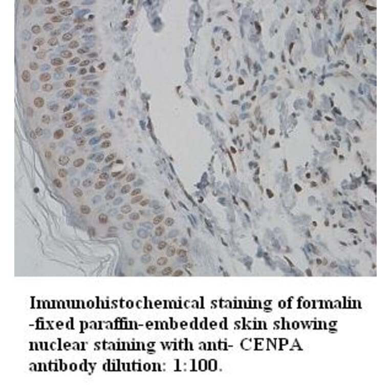 CENPA Antibody from Signalway Antibody (39344) - Antibodies.com
