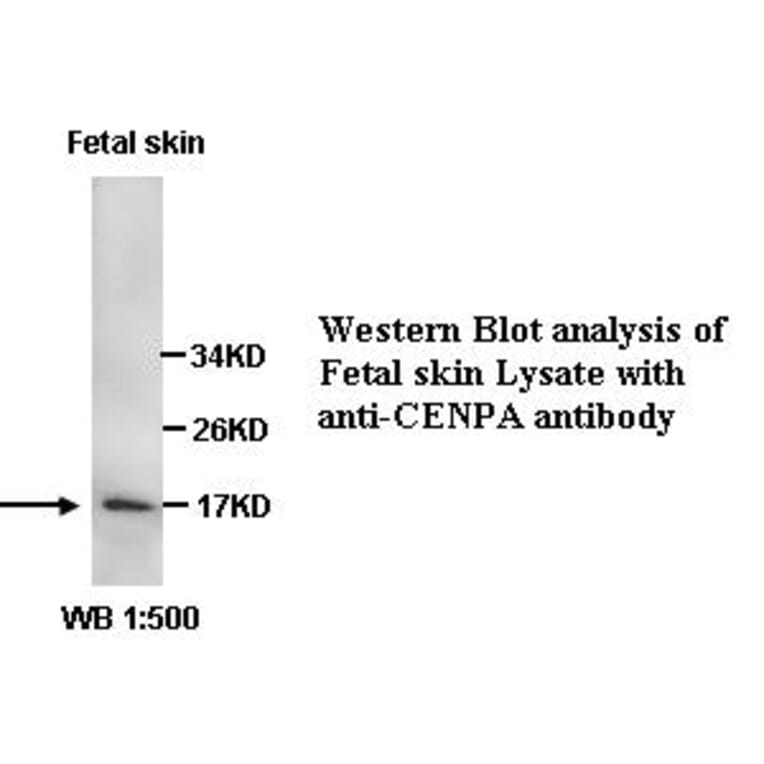 CENPA Antibody from Signalway Antibody (39344) - Antibodies.com