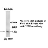 CENPA Antibody from Signalway Antibody (39344) - Antibodies.com
