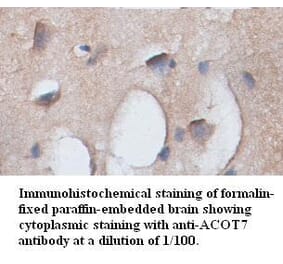 ACOT7 Antibody from Signalway Antibody (39350) - Antibodies.com