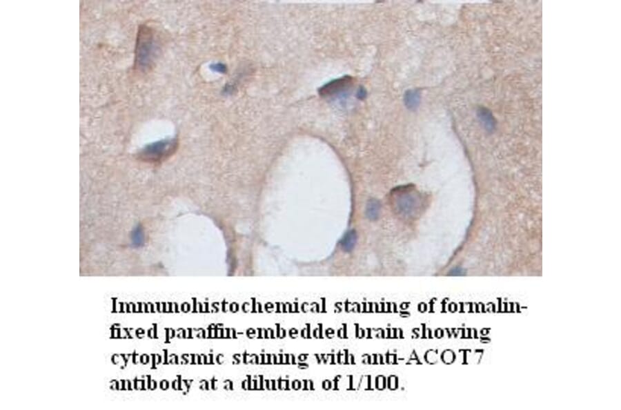 ACOT7 Antibody from Signalway Antibody (39350) - Antibodies.com