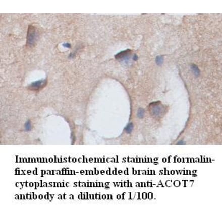 ACOT7 Antibody from Signalway Antibody (39350) - Antibodies.com