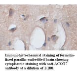 ACOT7 Antibody from Signalway Antibody (39350) - Antibodies.com
