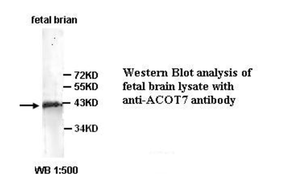 ACOT7 Antibody from Signalway Antibody (39350) - Antibodies.com