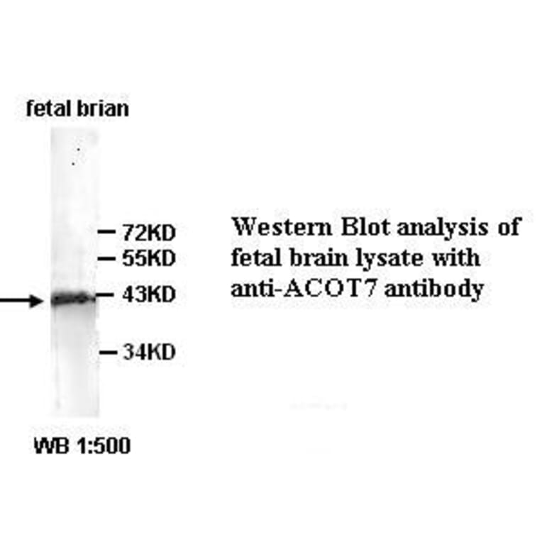 ACOT7 Antibody from Signalway Antibody (39350) - Antibodies.com