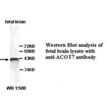ACOT7 Antibody from Signalway Antibody (39350) - Antibodies.com