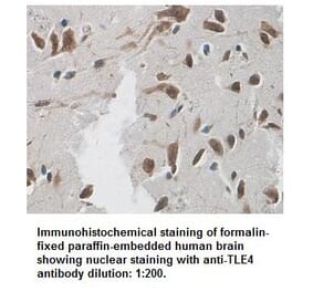 TLE4 Antibody from Signalway Antibody (39338) - Antibodies.com