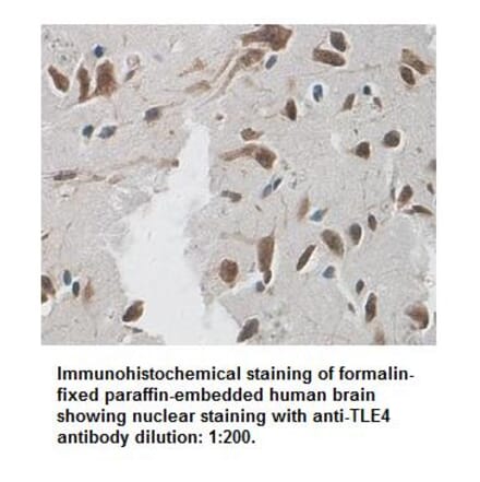 TLE4 Antibody from Signalway Antibody (39338) - Antibodies.com