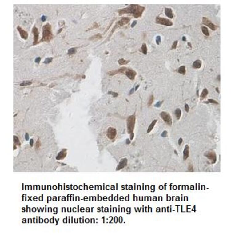 TLE4 Antibody from Signalway Antibody (39338) - Antibodies.com