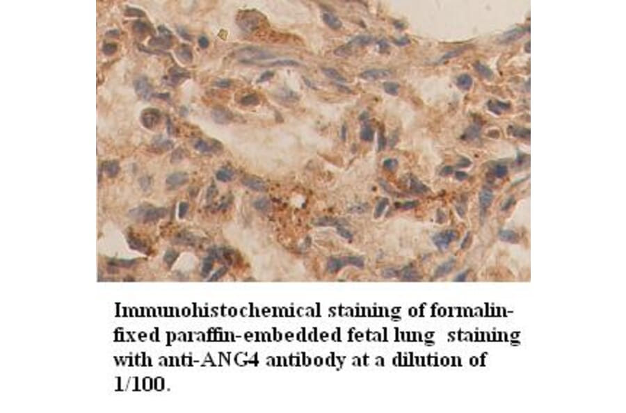 ANG4 Antibody from Signalway Antibody (39356) - Antibodies.com