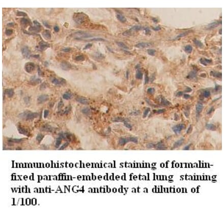 ANG4 Antibody from Signalway Antibody (39356) - Antibodies.com