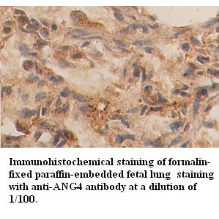 ANG4 Antibody from Signalway Antibody (39356) - Antibodies.com