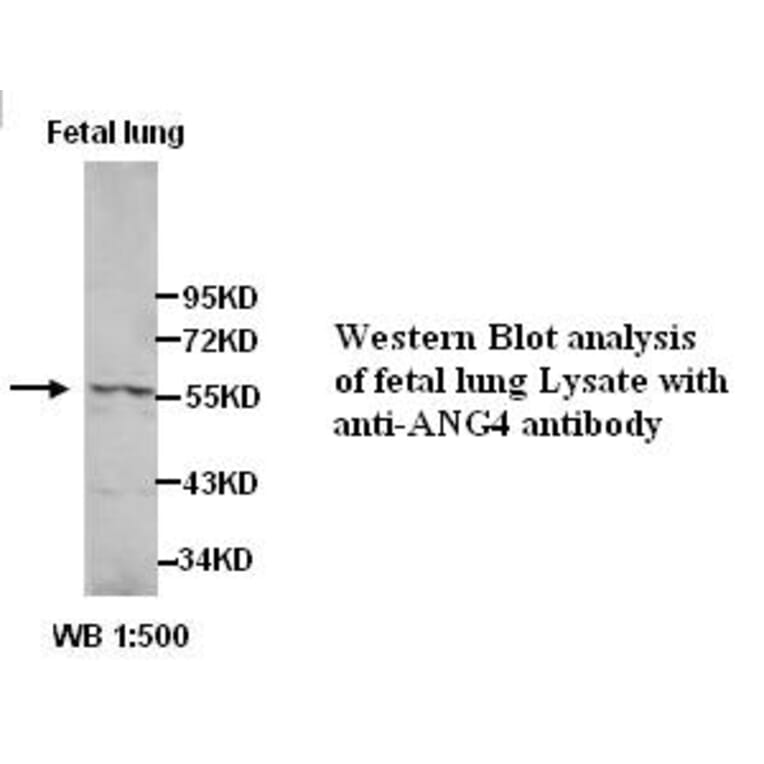 ANG4 Antibody from Signalway Antibody (39356) - Antibodies.com