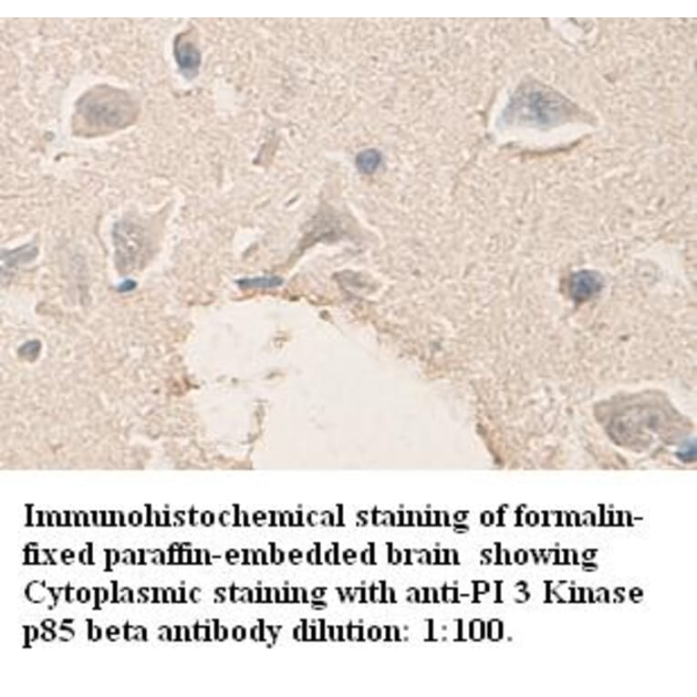 PI 3 Kinase p85 beta Antibody from Signalway Antibody (39331) - Antibodies.com