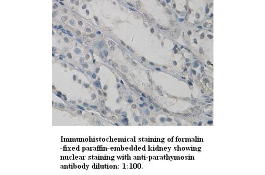 parathymosin Antibody from Signalway Antibody (39326) - Antibodies.com