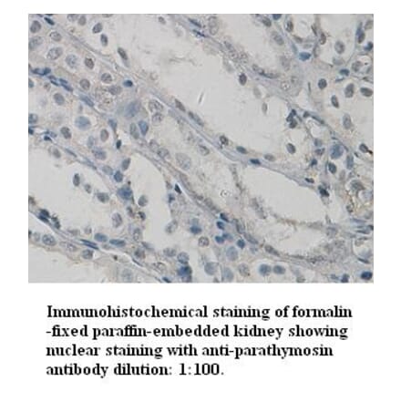 parathymosin Antibody from Signalway Antibody (39326) - Antibodies.com