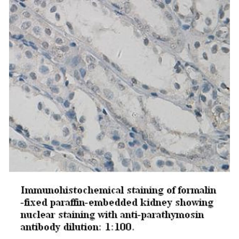 parathymosin Antibody from Signalway Antibody (39326) - Antibodies.com