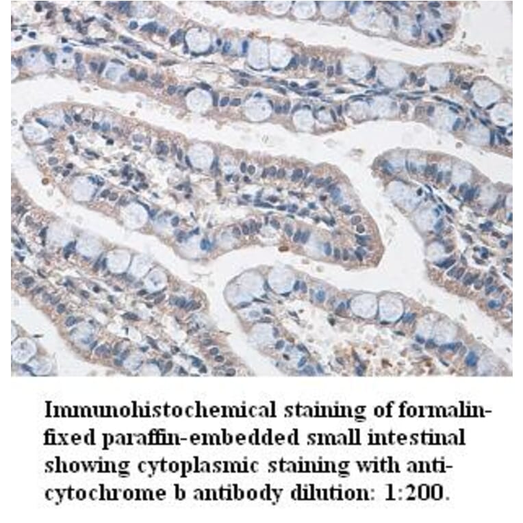 cytochrome b Antibody from Signalway Antibody (39342) - Antibodies.com