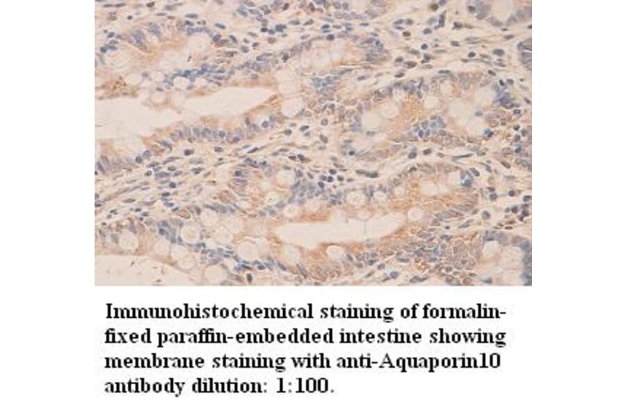 Aquaporin10 Antibody from Signalway Antibody (39320) - Antibodies.com