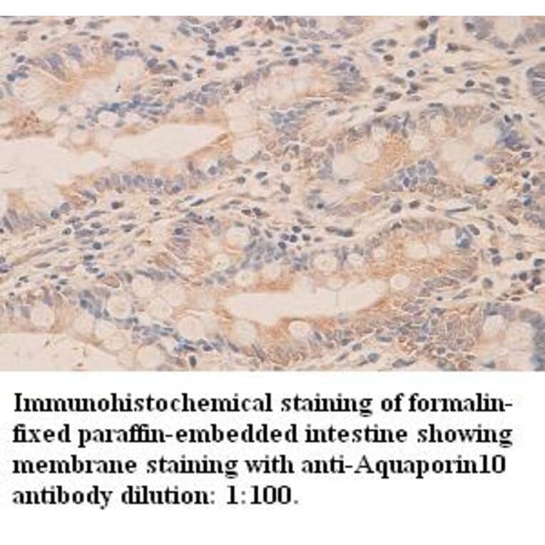 Aquaporin10 Antibody from Signalway Antibody (39320) - Antibodies.com