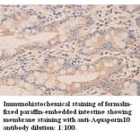 Aquaporin10 Antibody from Signalway Antibody (39320) - Antibodies.com
