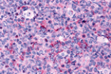 Immunohistochemistry - Caspase-3 Antibody from Signalway Antibody (25442) - Antibodies.com