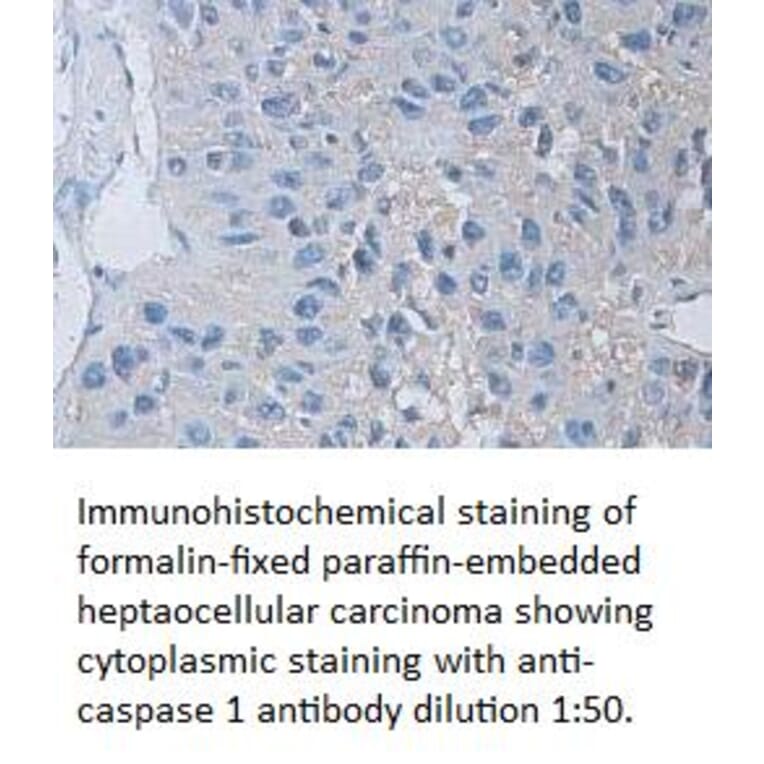 caspase 1 Antibody from Signalway Antibody (39310) - Antibodies.com