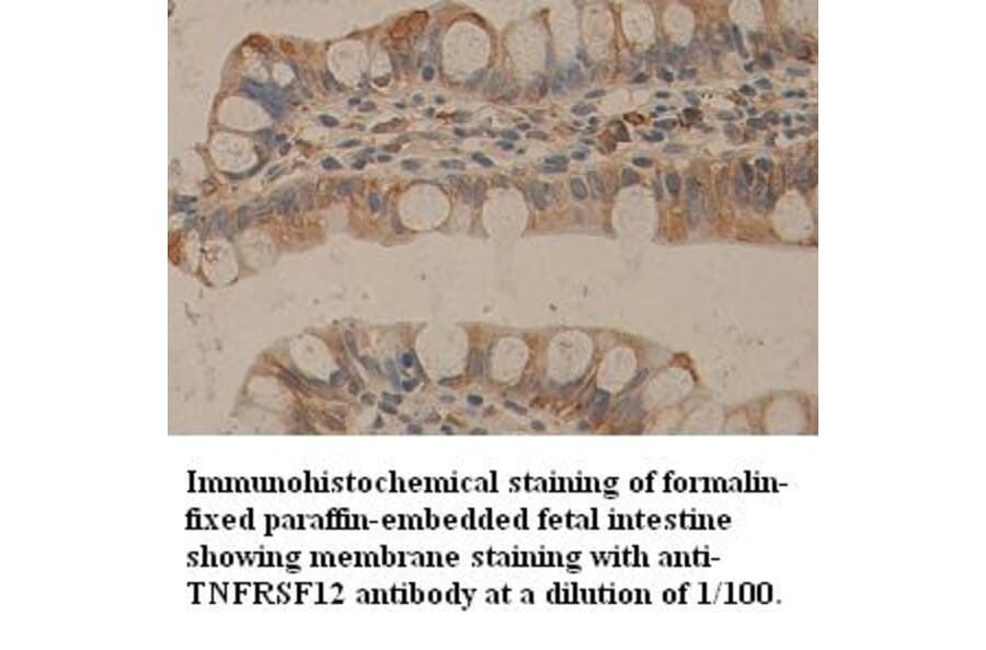 TNFRSF12 Antibody from Signalway Antibody (39357) - Antibodies.com