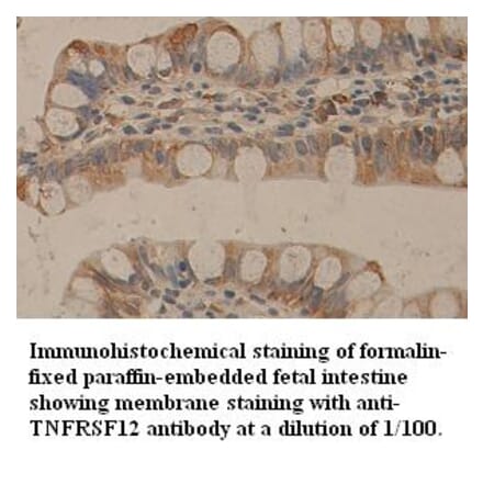 TNFRSF12 Antibody from Signalway Antibody (39357) - Antibodies.com