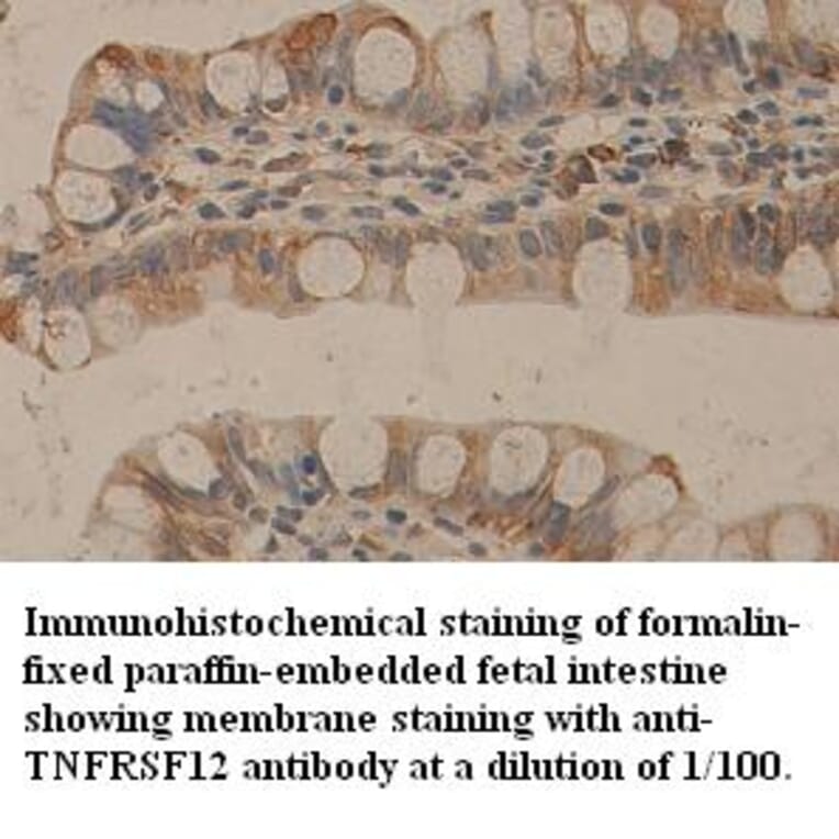 TNFRSF12 Antibody from Signalway Antibody (39357) - Antibodies.com