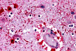 Immunohistochemistry - PIWI-L2 Antibody from Signalway Antibody (25453) - Antibodies.com