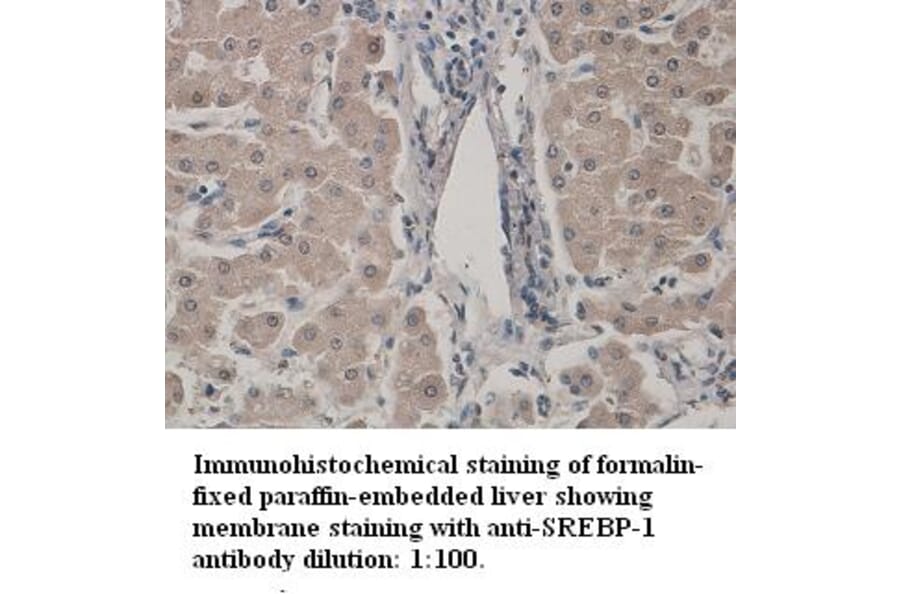 SREBP-1 Antibody from Signalway Antibody (39329) - Antibodies.com