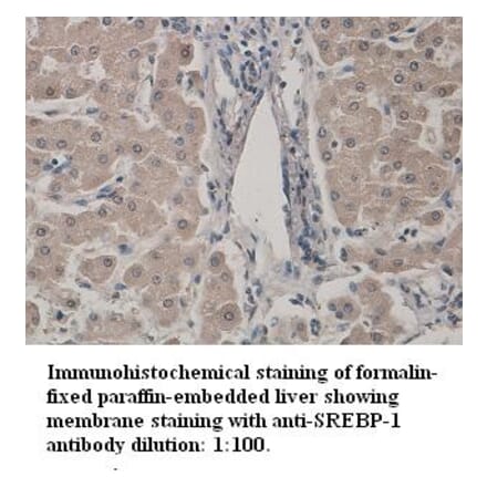 SREBP-1 Antibody from Signalway Antibody (39329) - Antibodies.com