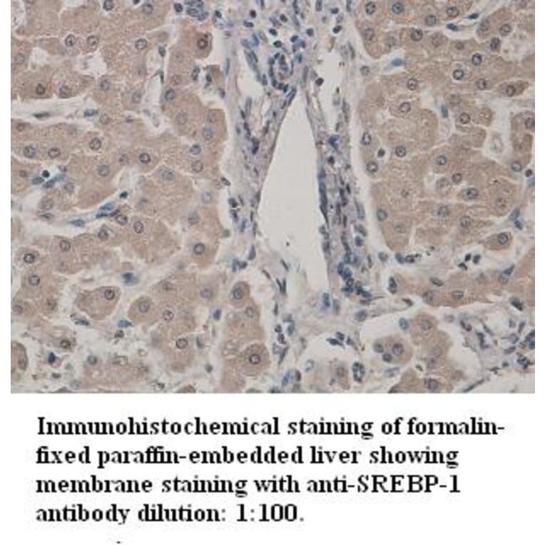 SREBP-1 Antibody from Signalway Antibody (39329) - Antibodies.com