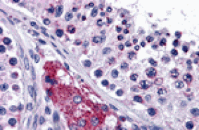 Immunohistochemistry - PTCHD2 Antibody from Signalway Antibody (24792) - Antibodies.com