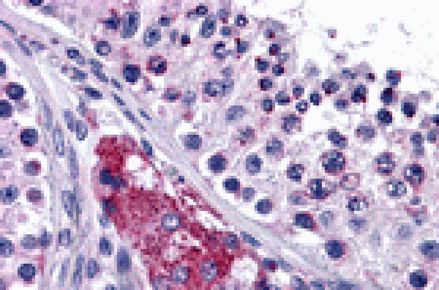 Immunohistochemistry - PTCHD2 Antibody from Signalway Antibody (24792) - Antibodies.com