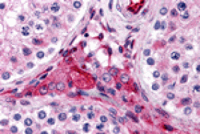 Immunohistochemistry - PTCHD2 Antibody from Signalway Antibody (24797) - Antibodies.com