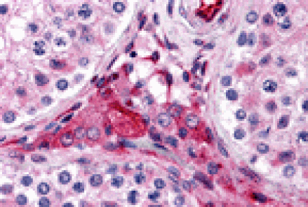 Immunohistochemistry - PTCHD2 Antibody from Signalway Antibody (24797) - Antibodies.com