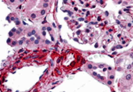 Immunohistochemistry - CARMA3 Antibody from Signalway Antibody (25438) - Antibodies.com