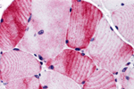 Immunohistochemistry - MYBPC1 Antibody from Signalway Antibody (25449) - Antibodies.com