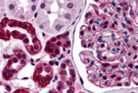 Immunohistochemistry - ZNF521 Antibody from Signalway Antibody (25454) - Antibodies.com