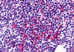 Immunohistochemistry of ZNF687 in human tonsil tissue with ZNF687 antibody at 5 µg/mL.