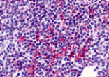 Immunohistochemistry - ZNF687 Antibody from Signalway Antibody (25455) - Antibodies.com