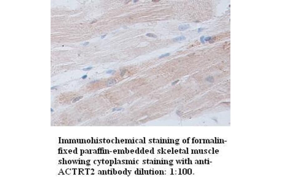 ACTRT2 Antibody from Signalway Antibody (39309) - Antibodies.com