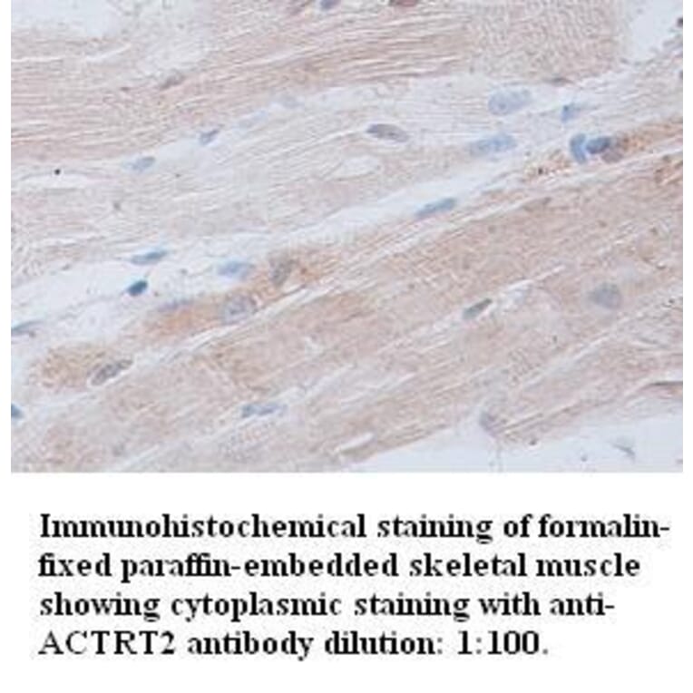 ACTRT2 Antibody from Signalway Antibody (39309) - Antibodies.com