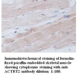 ACTRT2 Antibody from Signalway Antibody (39309) - Antibodies.com