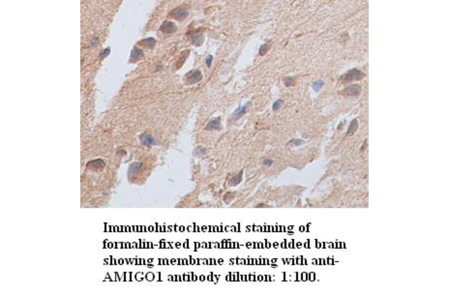 AMIGO1 Antibody from Signalway Antibody (39349) - Antibodies.com
