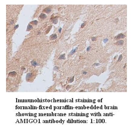 AMIGO1 Antibody from Signalway Antibody (39349) - Antibodies.com