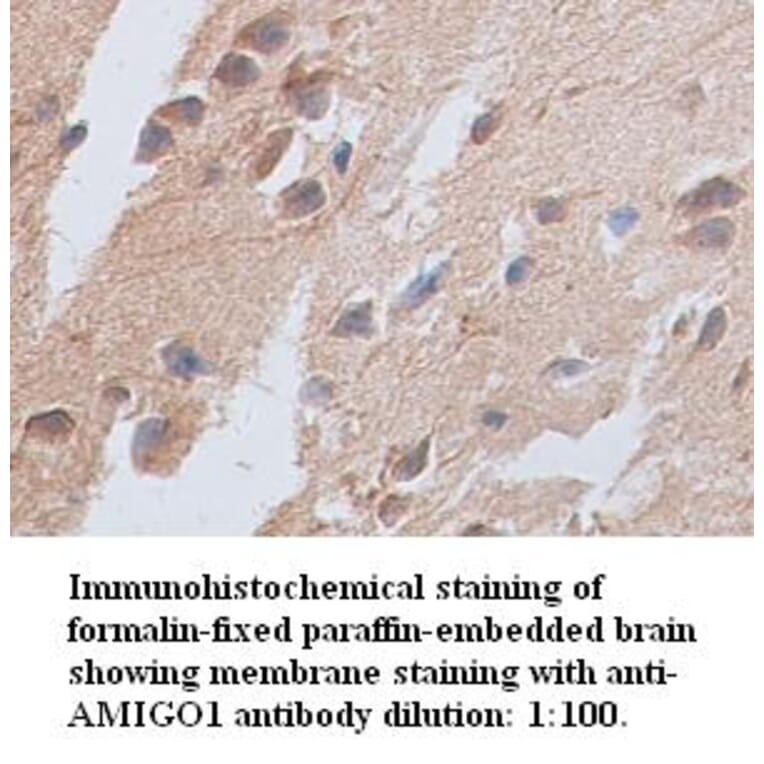 AMIGO1 Antibody from Signalway Antibody (39349) - Antibodies.com