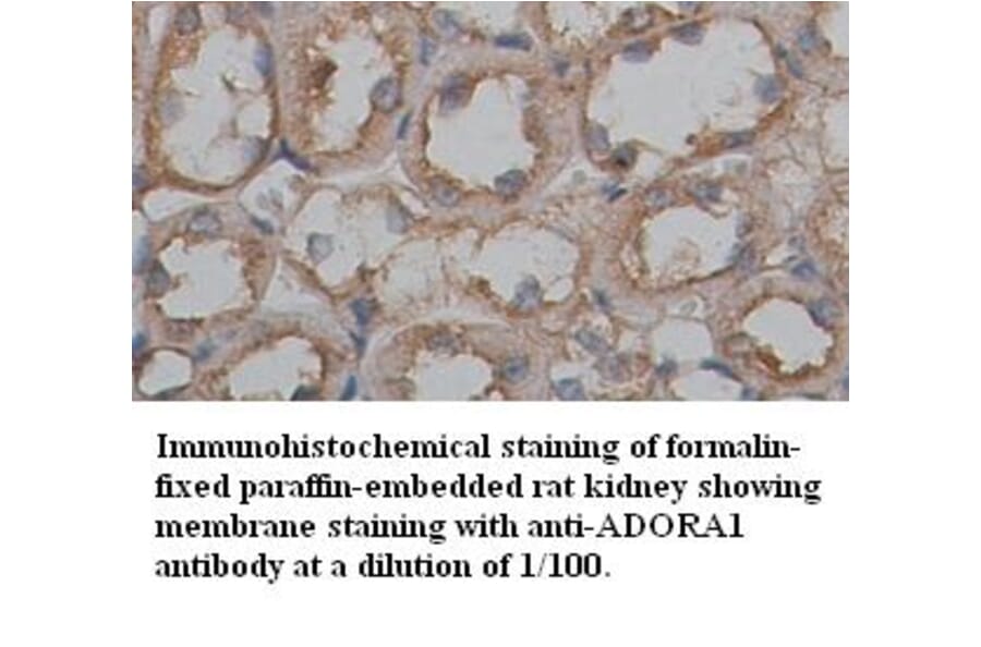 ADORA1 Antibody from Signalway Antibody (39355) - Antibodies.com